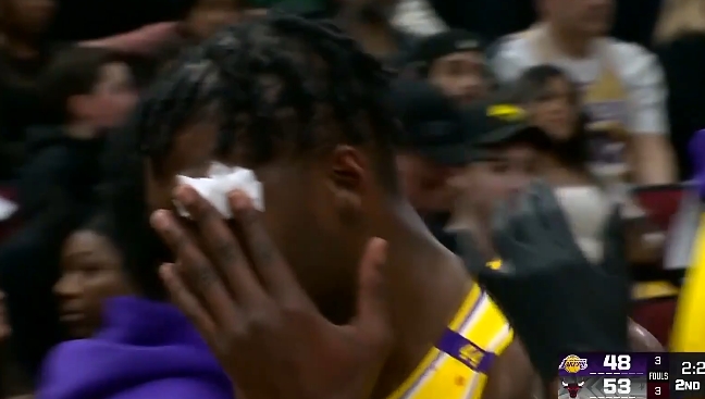 電風扇和許爾特卡位沖撞導致眼角出血 隨后怒推后者發泄&離場治療